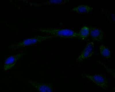 Immunocytochemistry/Immunofluorescence: Connexin 45/GJC1 Antibody [NBP2-76925] - ICC staining Connexin 45 in SH-SY5Y cells (green). Formalin fixed cells were permeabilized with 0.1% Triton X-100 in TBS for 10 minutes at room temperature and blocked with 1% Blocker BSA for 15 minutes at room temperature. Cells were probed with Connexin 45 antibody at a dilution of 1:100 for 1 hour at room temperature, washed with PBS. Alexa Fluorc 488 Goat anti-Mouse IgG was used as the secondary antibody at 1/100 dilution. The nuclear counter stain is DAPI (blue).