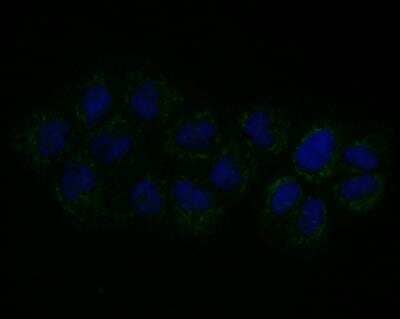 Immunocytochemistry/Immunofluorescence: Connexin 45/GJC1 Antibody [NBP2-76925] - ICC staining Connexin 45 in A431 cells (green). Formalin fixed cells were permeabilized with 0.1% Triton X-100 in TBS for 10 minutes at room temperature and blocked with 1% Blocker BSA for 15 minutes at room temperature. Cells were probed with Connexin 45 antibody at a dilution of 1:100 for 1 hour at room temperature, washed with PBS. Alexa Fluorc 488 Goat anti-Mouse IgG was used as the secondary antibody at 1/100 dilution. The nuclear counter stain is DAPI (blue).