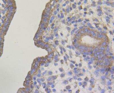 Immunohistochemistry: Connexin 45/GJC1 Antibody [NBP2-76925] - Immunohistochemical analysis of paraffin-embedded rat uterus tissue using anti-Connexin 45 / GJA7 / Cx45 antibody. The section was pre-treated using heat mediated antigen retrieval with Tris-EDTA buffer (pH 8.0-8.4) for 20 minutes.The tissues were blocked in 5% BSA for 30 minutes at room temperature, washed with ddH2O and PBS, and then probed with the antibody at 1/50 dilution, for 30 minutes at room temperature and detected using an HRP conjugated compact polymer system. DAB was used as the chromogen. Counter stained with hematoxylin and mounted with DPX.