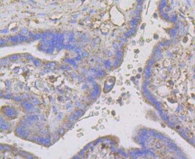 Immunohistochemistry: Connexin 45/GJC1 Antibody [NBP2-76925] - Immunohistochemical analysis of paraffin-embedded human placenta tissue using anti-Connexin 45 / GJA7 / Cx45 antibody. The section was pre-treated using heat mediated antigen retrieval with Tris-EDTA buffer (pH 8.0-8.4) for 20 minutes.The tissues were blocked in 5% BSA for 30 minutes at room temperature, washed with ddH2O and PBS, and then probed with the antibody at 1/50 dilution, for 30 minutes at room temperature and detected using an HRP conjugated compact polymer system. DAB was used as the chromogen. Counter stained with hematoxylin and mounted with DPX.