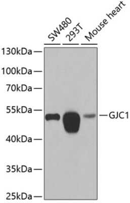 Western Blot: Connexin 45/GJC1 Antibody [NBP2-92802] - Analysis of extracts of various cell lines, using Connexin 45/GJC1 at 1:1000 dilution.Secondary antibody: HRP Goat Anti-Rabbit IgG (H+L) at 1:10000 dilution.Lysates/proteins: 25ug per lane.Blocking buffer: 3% nonfat dry milk in TBST.Detection: ECL Basic Kit .Exposure time: 30s.