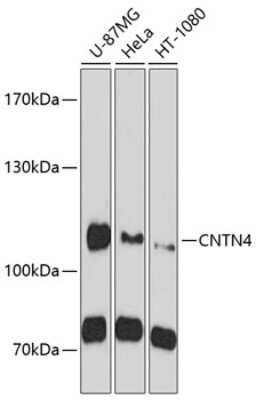 Western Blot: Contactin-4 Antibody [NBP2-92013] - Analysis of extracts of various cell lines, using Contactin-4 at 1:1000 dilution.Secondary antibody: HRP Goat Anti-Rabbit IgG (H+L) at 1:10000 dilution.Lysates/proteins: 25ug per lane.Blocking buffer: 3% nonfat dry milk in TBST.Detection: ECL Basic Kit .Exposure time: 90s.