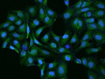 Immunocytochemistry/Immunofluorescence: Contactin-5 Antibody [NBP2-97316] - Immunofluorescence staining of Contactin-5 in U2OS cells. Cells were fixed with 4% PFA, permeabilzed with 0.1% Triton X-100 in PBS, blocked with 10% serum, and incubated with rabbit anti-Human Contactin-5 polyclonal antibody (dilution ratio 1:100) at 4C overnight. Then cells were stained with the Alexa Fluor(R)488-conjugated Goat Anti-rabbit IgG secondary antibody (green) and counterstained with DAPI (blue).Positive staining was localized to Cytoplasm.