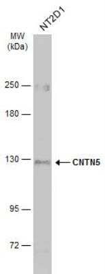 Western Blot: Contactin-5 Antibody [NBP2-15933] - Whole cell extract (30 ug) was separated by 5% SDS-PAGE, and the membrane was blotted with CNTN5 antibody [C1C3]  diluted at 1:500. The HRP-conjugated anti-rabbit IgG antibody (NBP2-19301) was used to detect the primary antibody, and the signal was developed with Trident ECL plus-Enhanced.