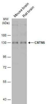 Western Blot: Contactin-5 Antibody [NBP2-15933] - Various tissue extracts (50 ug) were separated by 7.5% SDS-PAGE, and the membrane was blotted with CNTN5 antibody [C1C3]  diluted at 1:500. The HRP-conjugated anti-rabbit IgG antibody (NBP2-19301) was used to detect the primary antibody.