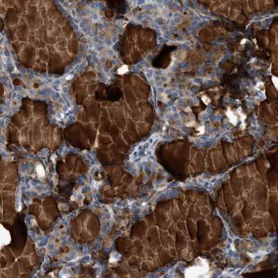 Immunohistochemistry-Paraffin: Contactin-6 Antibody [NBP1-91804] - Staining of human thyroid gland shows cytoplasmic positivity in glandular cells.