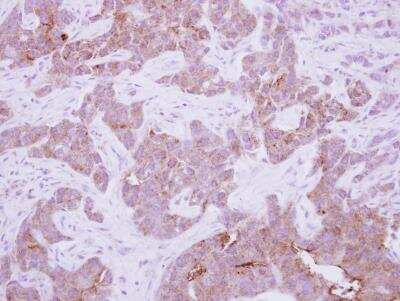 Immunohistochemistry-Paraffin Copine-6 Antibody