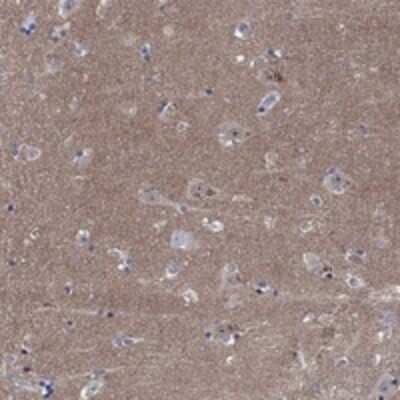 Immunohistochemistry-Paraffin: Copine-6 Antibody [NBP3-17234] - Staining of human hippocampus shows moderate cytoplasmic positivity in neuronal cells.