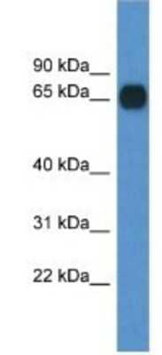 Western Blot: Copine-6 Antibody [NBP1-79763] - Mouse Pancreas Lysate 1ug/ml  Gel Concentration 12%