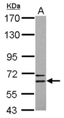 Western Blot Copine-6 Antibody