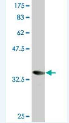 Western Blot: Coronin-1a Antibody (1A8) [H00011151-M03] - Detection against Immunogen (36.96 KDa) .