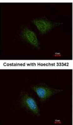 <b>Genetic Strategies Validation. </b>Immunocytochemistry/Immunofluorescence: Coronin 3 Antibody [NBP1-31283] - Analysis of methanol-fixed HeLa, using antibody at 1:200 dilution.