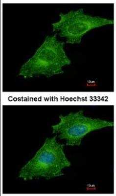 Immunocytochemistry/Immunofluorescence: Coronin 3 Antibody [NBP2-15968] - Analysis of methanol-fixed HeLa, using antibody at 1:500 dilution.
