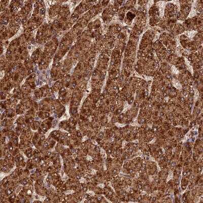 Immunohistochemistry-Paraffin: Coronin 3 Antibody [NBP1-85506] - Staining of human liver shows strong cytoplasmic positivity in hepatocytes.