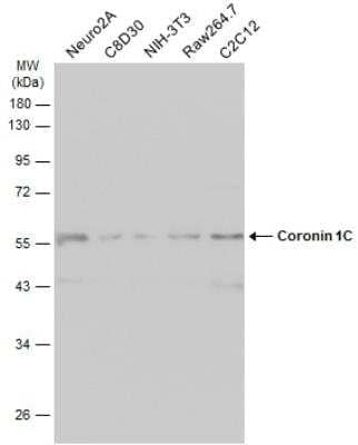 Western Blot: Coronin 3 Antibody [NBP1-31283] - Various whole cell extracts (30 ug) were separated by 10% SDS-PAGE, and the membrane was blotted with Coronin 1C antibody [C3], C-term diluted at 1:1000. The HRP-conjugated anti-rabbit IgG antibody (NBP2-19301) was used to detect the primary antibody, and the signal was developed with Trident ECL plus-Enhanced.