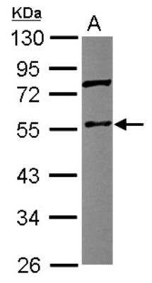 Western Blot: Coronin 3 Antibody [NBP2-15968] - Sample (30 ug of whole cell lysate) A: HeLa 10% SDS PAGE gel, diluted at 1:500.