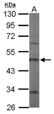 Western Blot: Coronin 3 Antibody [NBP2-15968] - Sample (30 ug of whole cell lysate) A: NIH-3T3 10% SDS PAGE gel, diluted at 1:2000.