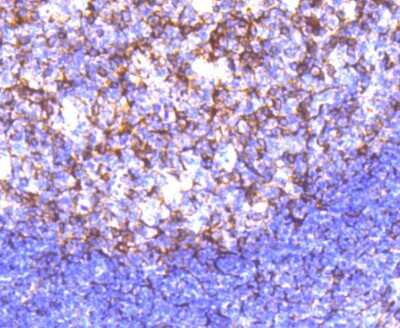 Immunohistochemistry-Paraffin: Cortactin Antibody (SC61-08) [NBP2-67632] - Analysis of paraffin-embedded human tonsil tissue using anti-Cortactin antibody. Counter stained with hematoxylin.