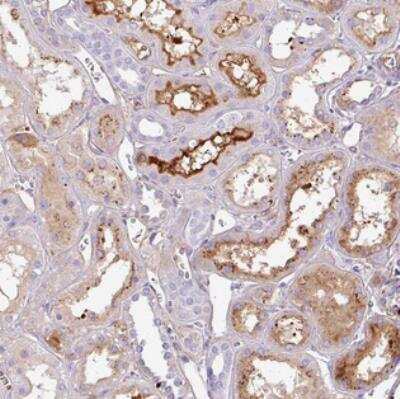Immunohistochemistry: Cortexin 2 Antibody [NBP2-30534] - Staining of human kidney shows strong membranous and cytoplasmic positivity in subset of cells in tubules.