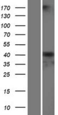 Western Blot Serpin A6/Cortisol Binding Globulin Overexpression Lysate