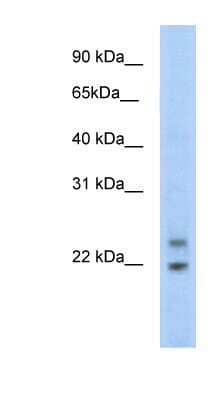 Western Blot: Cphx Antibody [NBP1-91616] - SP2/0 cell lysate, concentration 5.0ug/ml.