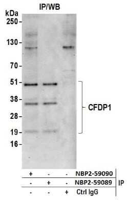 Immunoprecipitation: Craniofacial Development Protein 1 Antibody [NBP2-59090] - Detection of immunoprecipitates. Samples: Whole cell lysate (0.5 or 1.0 mg per IP reaction; 20% of IP loaded) from HeLa cells prepared using NETN lysis buffer. Antibodies: Affinity purified rabbit anti-CFDP1 antibody A305-653A-M NBP2-59090 used for IP at 8 ul per reaction. CFDP1 was also immunoprecipitated by rabbit anti-CFDP1 antibody NBP2-59089. For blotting immunoprecipitated CFDP1, NBP2-59090 was used at 1:400. Detection: Chemiluminescence with an exposure time of 30 seconds.