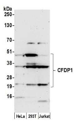 Western Blot: Craniofacial Development Protein 1 Antibody [NBP2-59089] - Detection of human CFDP1 by western blot. Samples: Whole cell lysate (50 ug) from HeLa, 293T, and Jurkat cells prepared using NETN lysis buffer. Antibody: Affinity purified rabbit anti-CFDP1 antibody NBP2-59089 used for WB at 1:1000. Detection: Chemiluminescence with an exposure time of 3 minutes.