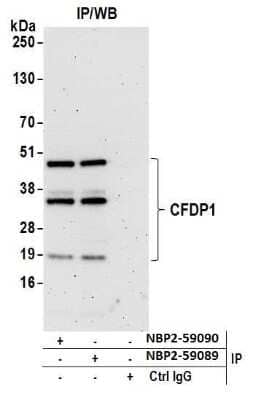Western Blot: Craniofacial Development Protein 1 Antibody [NBP2-59089] - Detection of human CFDP1 by western blot of immunoprecipitates. Samples: Whole cell lysate (0.5 or 1.0 mg per IP reaction; 20% of IP loaded) from 293T cells prepared using NETN lysis buffer. Antibodies: Affinity purified rabbit anti-CFDP1 antibody NBP2-59089 used for IP at 20 ul per reaction. CFDP1 was also immunoprecipitated by rabbit anti-CFDP1 antibody NBP2-59090. For blotting immunoprecipitated CFDP1, A305-624A-M was used at 1:200. Detection: Chemiluminescence with an exposure time of 3 minutes.