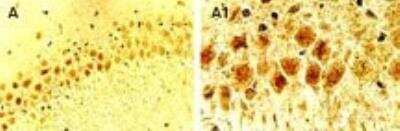 Immunohistochemistry: Cre Antibody - Unpurified [NB100-56134] - Cre Antibody [NB100-56134] - Analysis of Cre in a FFPE tissue section from the hippocampus of a Cre transgenic mouse at 1:2000. In this mouse line, Cre is expressed in the brain, predominantly in the nuclei of most types of neurons. Hematoxylin-eosin counterstain. A1 is a higher magnification of A.