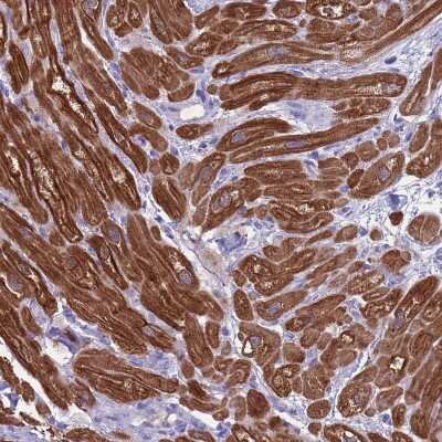 Immunohistochemistry-Paraffin: Creatine Kinase, Muscle/CKMM Antibody [NBP2-13839] - Staining of human heart muscle shows strong cytoplasmic positivity in cardiomyocytes.