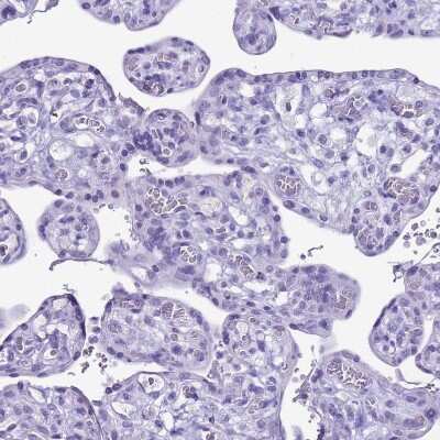 Immunohistochemistry-Paraffin: Creatine Kinase, Muscle/CKMM Antibody [NBP2-13839] - Staining of human placenta shows no positivity in trophoblastic cells as expected.