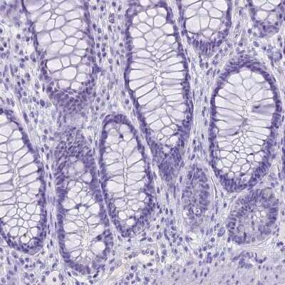 Immunohistochemistry-Paraffin: Creatine Kinase, Muscle/CKMM Antibody [NBP2-13839] - Staining of human rectum shows no positivity in glandular cells as expected.