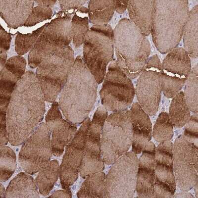 Immunohistochemistry-Paraffin: Creatine Kinase, Muscle/CKMM Antibody [NBP2-13839] - Staining of human skeletal muscle shows strong cytoplasmic positivity in myocytes.