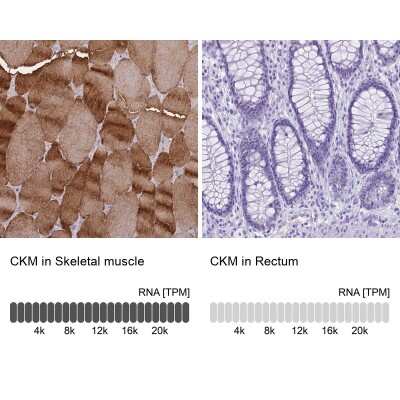 Immunohistochemistry-Paraffin: Creatine Kinase, Muscle/CKMM Antibody [NBP2-13839] - Analysis in human skeletal muscle and rectum tissues using NBP2-13839 antibody. Corresponding CKM RNA-seq data are presented for the same tissues.