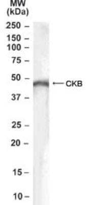 Western Blot: Creatine Kinase B Antibody [NB100-2847] - Analysis using NB100-2847 at 0.1 ug/ml in Human Brain lysate (35ug protein in RIPA buffer). Primary incubation was 1 hour. Detected by chemiluminescence.