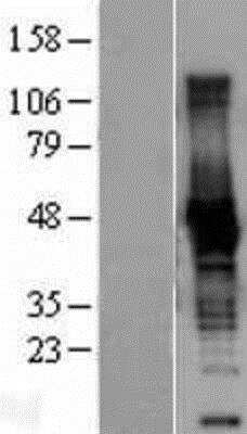 Western Blot: Creatine Kinase B Overexpression Lysate (Native) [NBL1-09218] - Left-Empty vector transfected control cell lysate (HEK293 cell lysate); Right -Over-expression Lysate for Creatine Kinase BB.