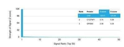 Protein Array: Creatine Kinase BB Antibody (2ba6) - Azide and BSA Free [NBP2-59601] - Analysis of Protein Array containing more than 19,000 containing more than 19,000 full-length human proteins. Z-  and  S-  Score:  The  Z-score  represents  the  strength  of  a  signal  that  a  monoclonal  antibody (in  combination  with  a fluorescently-tagged anti-IgG secondary  antibody) produces  when binding to a particular protein on the HuProtTM array. Z-scores are described in units of standard deviations above the mean value of all signals generated on that array. If targets on HuProt are arranged in descending order of the Z-score, the S-score is the difference between the Z-score. S-score therefore represents  the  relative  target  specificity  of  Ab  to  its  intended  target.