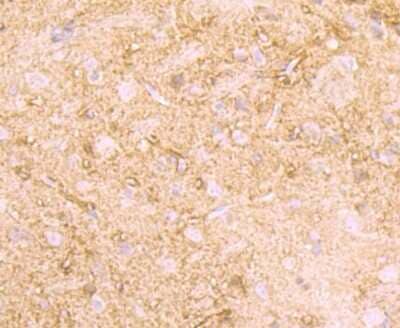Immunohistochemistry-Paraffin: Creatine Kinase BB Antibody (JB78-34) [NBP2-75446] - Analysis of paraffin-embedded rat brain tissue using anti-Creatine kinase B type antibody. Counter stained with hematoxylin.