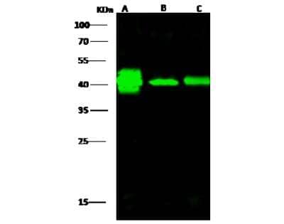 Western Blot: Creatine Kinase BB Antibody [NBP3-00288] - Anti-Creatine Kinase BB rabbit polyclonal antibody at 1:500 dilution. Lane A: Jurkat Whole Cell Lysate. Lane B: Hela Whole Cell Lysate. Lane C: A431 Whole Cell Lysate. Lysates/proteins at 30 ug per lane. Secondary Goat Anti-Rabbit IgG H&L (Dylight 800) at 1/10000 dilution. Developed using the Odyssey technique. Performed under reducing conditions. Predicted band size: 43 kDa. Observed band size: 43 kDa