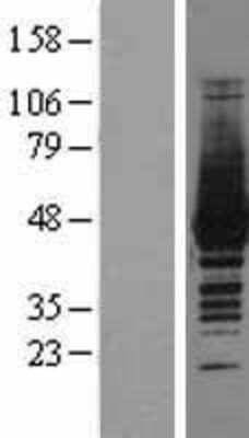 Western Blot Creatine Kinase, Muscle/CKMM Overexpression Lysate