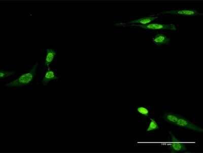 Immunocytochemistry/Immunofluorescence: Creatine Kinase, Muscle/CKMM Antibody (2F3-B11) [H00001158-M06] - Analysis of monoclonal antibody to CKM on HeLa cell. Antibody concentration 40 ug/ml