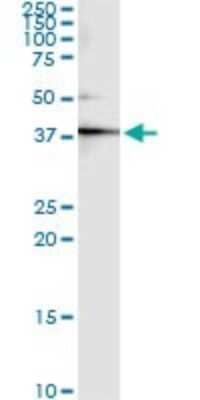 Immunoprecipitation: Creatine Kinase, Muscle/CKMM Antibody (3E1-F3) [H00001158-M01] - Analysis of CKM transfected lysate using anti-CKM monoclonal antibody and Protein A Magnetic Bead, and immunoblotted with CKM MaxPab rabbit polyclonal antibody.