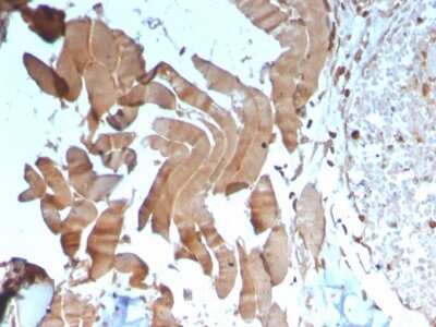 Immunohistochemistry-Paraffin: Creatine Kinase, Muscle/CKMM Antibody (CKMM/3341) - Azide and BSA Free [NBP3-08304] - Formalin-fixed, paraffin-embedded human skeletal muscle stained with Creatine Kinase, Muscle/CKMM Antibody (CKMM/3341).