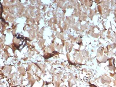 Immunohistochemistry-Paraffin: Creatine Kinase, Muscle/CKMM Antibody (CKMM/3341) - Azide and BSA Free [NBP3-08304] - Formalin-fixed, paraffin-embedded human skeletal muscle stained with Creatine Kinase, Muscle/CKMM Antibody (CKMM/3341).