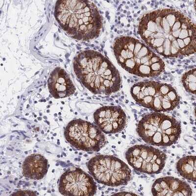 Immunohistochemistry-Paraffin Creatine kinase MT 1A Antibody