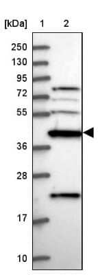 Western Blot Creatine kinase MT 1A Antibody