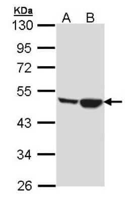 Western Blot Creatine kinase MT 1A Antibody