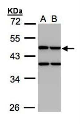 Western Blot Creatine kinase MT 1B Antibody