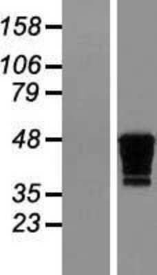 Western Blot: Creatine kinase MT 1B Overexpression Lysate (Adult Normal) [NBL1-09222] Left-Empty vector transfected control cell lysate (HEK293 cell lysate); Right -Over-expression Lysate for Creatine kinase MT 1B.