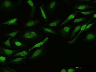 Immunocytochemistry/Immunofluorescence: Crk Antibody [H00001398-D01P] - Analysis of antibody to CRK on HeLa cell. Antibody concentration 10 ug/ml.